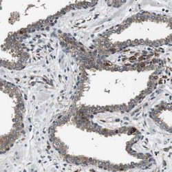 Invitrogen PALD1 Polyclonal Antibody 100 &mu;L; Unconjugated:Antibodies,