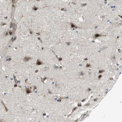Invitrogen PALD1 Polyclonal Antibody 100 &mu;L; Unconjugated:Antibodies,