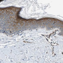 Invitrogen PALD1 Polyclonal Antibody 100 &mu;L; Unconjugated:Antibodies,