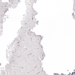 Invitrogen GP2 Polyclonal Antibody 100 &mu;L; Unconjugated:Antibodies,