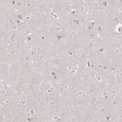 Invitrogen GP2 Polyclonal Antibody 100 &mu;L; Unconjugated:Antibodies,