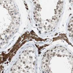 Invitrogen NEK4 Polyclonal Antibody 100 &mu;L; Unconjugated:Antibodies,