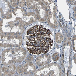 Invitrogen SLK Polyclonal Antibody 100 &mu;L; Unconjugated:Antibodies,