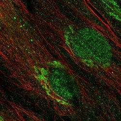 Invitrogen PFTK2 Polyclonal Antibody 100 &mu;L; Unconjugated:Antibodies,
