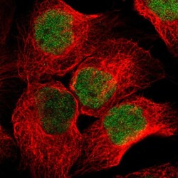 Invitrogen NSD2 Polyclonal Antibody 100 &mu;L; Unconjugated:Antibodies,