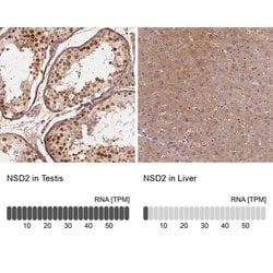 Invitrogen NSD2 Polyclonal Antibody 100 &mu;L; Unconjugated:Antibodies,