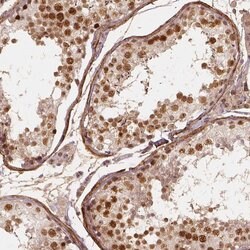 Invitrogen NSD2 Polyclonal Antibody 100 &mu;L; Unconjugated:Antibodies,