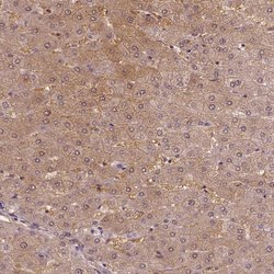 Invitrogen NSD2 Polyclonal Antibody 100 &mu;L; Unconjugated:Antibodies,