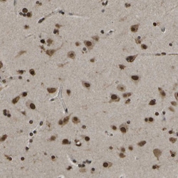 Invitrogen SPEN Polyclonal Antibody 100 &mu;L; Unconjugated:Antibodies,