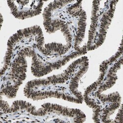 Invitrogen SPEN Polyclonal Antibody 100 &mu;L; Unconjugated:Antibodies,