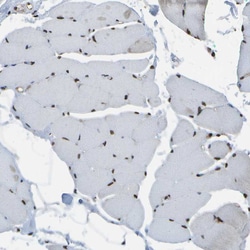 Invitrogen SPEN Polyclonal Antibody 100 &mu;L; Unconjugated:Antibodies,