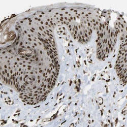 Invitrogen SPEN Polyclonal Antibody 100 &mu;L; Unconjugated:Antibodies,