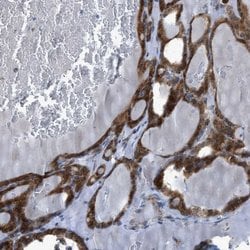 Invitrogen RBBP9 Polyclonal Antibody 100 &mu;L; Unconjugated:Antibodies,