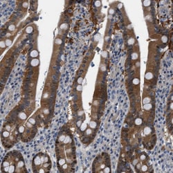Invitrogen TMEM45B Polyclonal Antibody 100 &mu;L; Unconjugated:Antibodies,