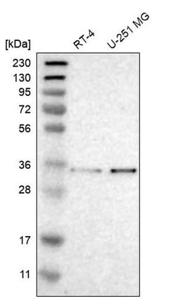 MFAP3 Polyclonal Antibody 100 &mu;L | Buy Online | Thermo Scientific | Fisher Scientific