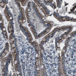Invitrogen FAM3B Polyclonal Antibody 100 &mu;L; Unconjugated:Antibodies,