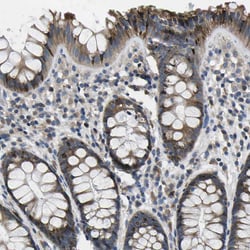 Invitrogen ERGIC3 Polyclonal Antibody 100 &mu;L; Unconjugated:Antibodies,