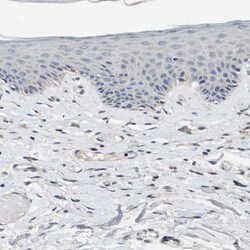 Invitrogen ERGIC3 Polyclonal Antibody 100 &mu;L; Unconjugated:Antibodies,