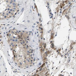 Invitrogen ERGIC3 Polyclonal Antibody 100 &mu;L; Unconjugated:Antibodies,