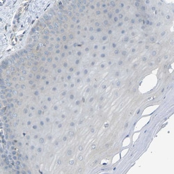 Invitrogen PIEZO2 Polyclonal Antibody 100 &mu;L; Unconjugated:Antibodies,