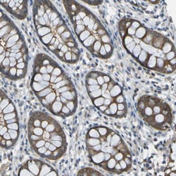 Invitrogen PIEZO2 Polyclonal Antibody 100 &mu;L; Unconjugated:Antibodies,