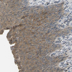 Invitrogen PIEZO2 Polyclonal Antibody 100 &mu;L; Unconjugated:Antibodies,