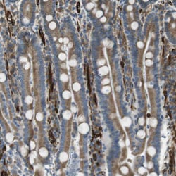 Invitrogen C1orf27 Polyclonal Antibody 100 &mu;L | Buy Online | Invitrogen&trade; | Fisher Scientific
