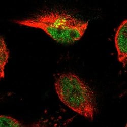 TSPAN3 Polyclonal Antibody, Invitrogen 100 &mu;L; Unconjugated:Antibodies,