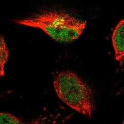 TSPAN3 Polyclonal Antibody, Invitrogen&trade; 100 &mu;L; Unconjugated 