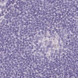 Invitrogen ASGR2 Polyclonal Antibody 100 &mu;L; Unconjugated:Antibodies,