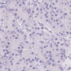 Invitrogen ASGR2 Polyclonal Antibody 100 &mu;L; Unconjugated:Antibodies,