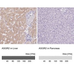 Invitrogen ASGR2 Polyclonal Antibody 100 &mu;L; Unconjugated:Antibodies,