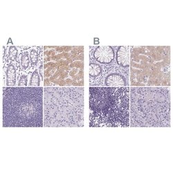 Invitrogen ASGR2 Polyclonal Antibody 100 &mu;L; Unconjugated:Antibodies,