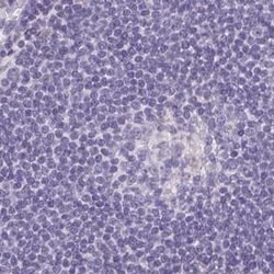 Invitrogen ASGR2 Polyclonal Antibody 100 &mu;L; Unconjugated:Antibodies,