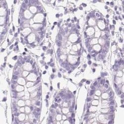 Invitrogen ASGR2 Polyclonal Antibody 100 &mu;L; Unconjugated:Antibodies,
