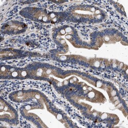 Invitrogen KV1.4 (KCNA4) Polyclonal Antibody 100 &mu;L; Unconjugated:Antibodies,