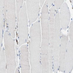 Invitrogen HSD17B12 Polyclonal Antibody 100 &mu;L; Unconjugated:Antibodies,