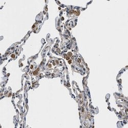 Invitrogen HSD17B12 Polyclonal Antibody 100 &mu;L; Unconjugated:Antibodies,