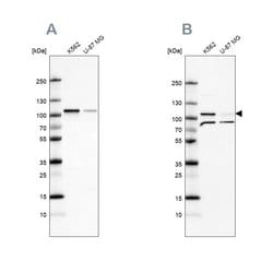 Invitrogen SRPK1 Polyclonal Antibody 100 &mu;L | Buy Online | Invitrogen&trade; | Fisher Scientific