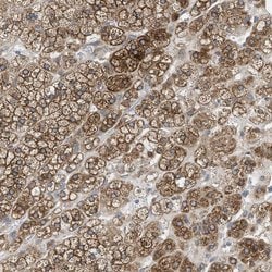 Invitrogen AGPAT6 Polyclonal Antibody 100 &mu;L; Unconjugated:Antibodies,