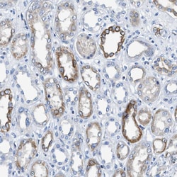 Invitrogen TAUT Polyclonal Antibody 100 &mu;L; Unconjugated:Antibodies,