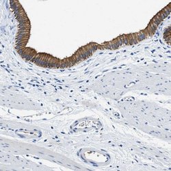 Invitrogen TAUT Polyclonal Antibody 100 &mu;L; Unconjugated:Antibodies,