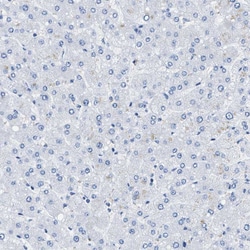 Invitrogen Bisphosphoglycerate mutase Polyclonal Antibody 100 &mu;L; Unconjugated:Antibodies,