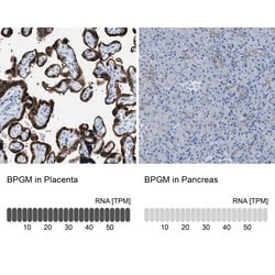 Invitrogen Bisphosphoglycerate mutase Polyclonal Antibody 100 &mu;L; Unconjugated:Antibodies,