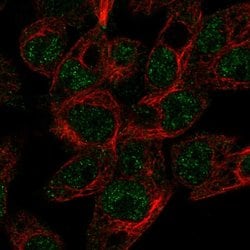 Invitrogen ABCG5 Polyclonal Antibody 100 &mu;L; Unconjugated:Antibodies,