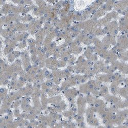 Invitrogen WNK2 Polyclonal Antibody 100 &mu;L; Unconjugated:Antibodies,