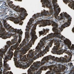 Invitrogen WNK2 Polyclonal Antibody 100 &mu;L; Unconjugated:Antibodies,