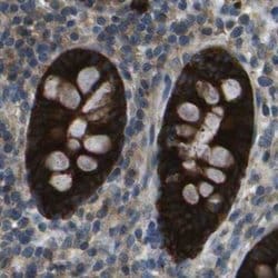 Invitrogen WNK2 Polyclonal Antibody 100 &mu;L; Unconjugated:Antibodies,