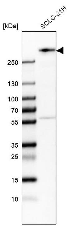Invitrogen WNK2 Polyclonal Antibody 100 &mu;L; Unconjugated:Antibodies,