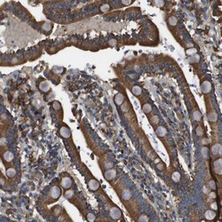 CNPY3 Polyclonal Antibody:Antibodies, Polyclonal